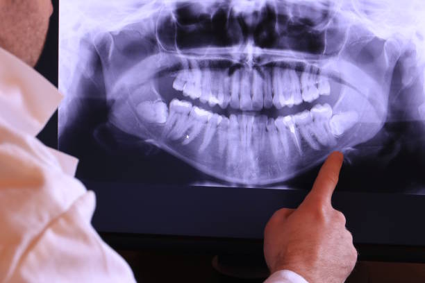 Best Emergency Denture Repair in Moriarty, NM